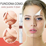 Caneta Restorative™ + Brinde Exclusivo