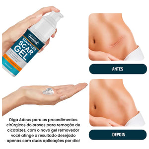 ADVANCED SCAR GEL + BRINDE EXCLUSIVO -  SOMENTE HOJE 🎁