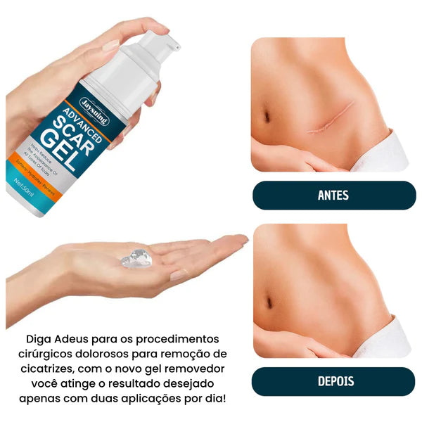 ADVANCED SCAR GEL + BRINDE EXCLUSIVO -  SOMENTE HOJE 🎁